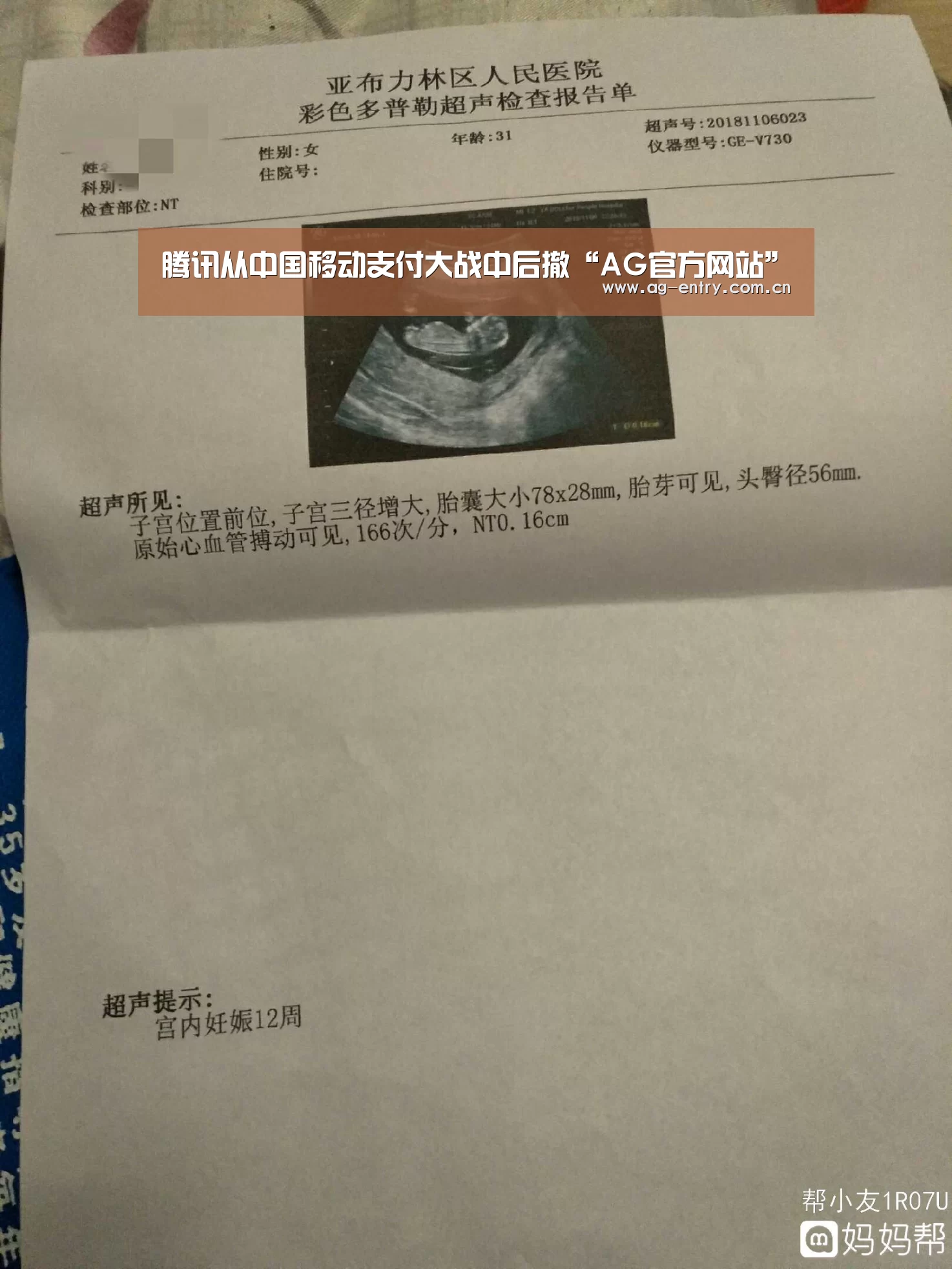 腾讯从中国移动支付大战中后撤“AG官方网站”(图2) AG真人娱乐